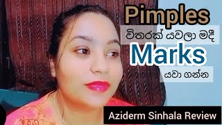 🦋 Azelaic Acid  Aziderm Sinhala Honest Review 🦋 [upl. by Carlson]