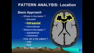 Brain Lesion Location Part 1flv [upl. by Sulamith150]