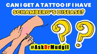 CAN I GET A TATTOO IF I HAVE SCHAMBERG’S DISEASE [upl. by Mcnutt]