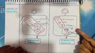 Coombs test explained  Antiglobulin Test  AHG reagent  Principle  Signficance [upl. by Judd]