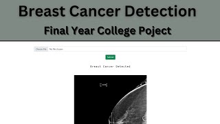 Machine Learning Tutorial on Breast Cancer Dataset With Python [upl. by Esyla961]