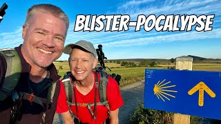 Camino 12 Nájera to Santo Domingo The Truth About Camino Blisters 🇪🇸 caminofrances [upl. by Seidnac]