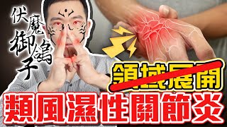 類風濕性關節炎 這些藥不能亂吃 關節腫痛 當心就是類風濕 [upl. by Greiner]