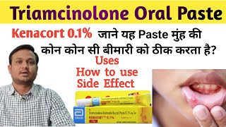 Kenacort 01  Kenacort gel how to use  Triamcinolone oromucosal paste bp 01 ww in hindi [upl. by Synned]