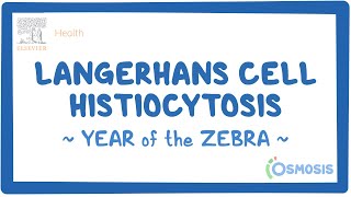 Langerhans cell histiocytosis Year of the Zebra [upl. by Anitsrhc]