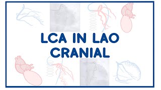 LAO Cranial  Left Coronary Artery [upl. by Ansaev]