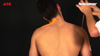 Taping Elastico®  Applicazione Cervicale [upl. by Drazze]