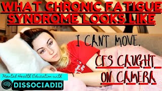 WHAT CFS LOOKS LIKE CAUGHT ON CAMERA  CHRONIC FATIGUE SYNDROMEMYALGIC ENCEPHALOMYELITIS [upl. by Norra139]