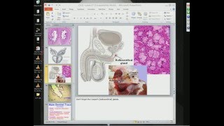 Medical School Pathology 2012 Session 061 Lower Urinary Tract Lab and Male Genital Tractmp4 [upl. by Ogata]