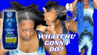 SELSUN BLUE Naturals Anti DANDRUFF Shampoo Tutorial and Review [upl. by Fachini459]