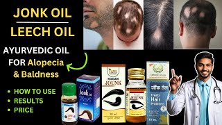 LEECH OIL  JONK OIL  FOR ALOPECIA  JONK KA TEL  HOW TO USE  REVIEW amp RESULTS  ESSENTIAL OIL [upl. by Joliet]