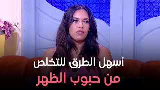 لو بتعاني من حبوب الظهر في الصيف  اعرفي أسهل الطرق للتخلص منها [upl. by Levesque]