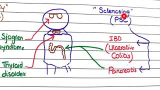 Primary Biliary Cholangitis and Primary Sclerosing Cholangitis  Pathology [upl. by Aldous]