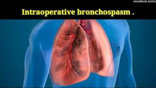 intraoperative bronchospasm [upl. by Dorina]