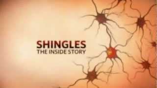 Shingles The Inside Story [upl. by Prosperus650]