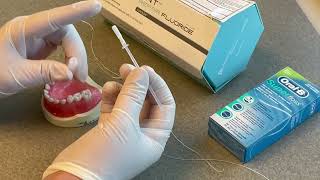 Proximal Curodont Repair Tutorial for Enamel Remineralization with Hydroxyapatite [upl. by Harneen]