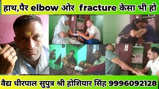 हाथ का फ्रैक्चर और इलाजhand fracture or treatmentwristfracture kneefracturealbowfracturedesilaj [upl. by Asilrak]