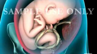 Breech Birth Position  3D Rotation [upl. by Ecirual300]