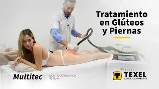 Vacumterapia con radiofrecuencia PEMF y lipolisis laser en Gluteos y Piernas  Multitec  Texel SRL [upl. by Mohl]