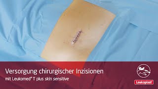 Leukoplast Leukomed T plus skin sensitive – Versorgung chirurgischer Inzisionen [upl. by Donnenfeld]