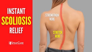 Best Scoliosis Exercises for Pain and Posture NO EQUIPMENT [upl. by Avruch]