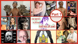 અજીબોગરીબ મેડીકલ બીમારીઓ  પાર્ટ ૧ Rare  Weird  Bizzare  strange  Mind Boggling Medical Diseases [upl. by Muncey]