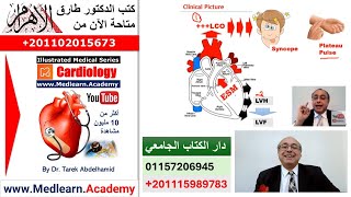 Aortic Stenosis usmle internalmedicine cme medicaleducation ecg محاضراتباطنة medical [upl. by Coppins]