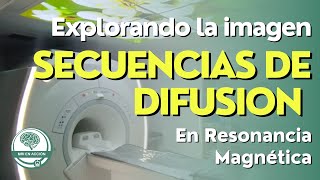 DIFUSION POR RESONANCIA MAGNETICA [upl. by Aniratak]