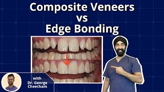 Composite Veneers vs Edge Bonding  Biomimetic Dentistry with George The Dentist  PDP075 [upl. by Walcott]