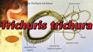 Trichuris trichiura [upl. by Anaz]