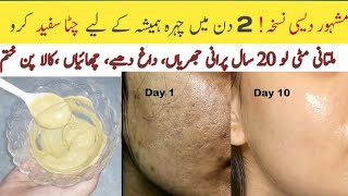 Multani Mitti Face Pack Multani Mitti Face Pack For Glass Skin  Best Face Pack For Acne Free Face [upl. by Milty]