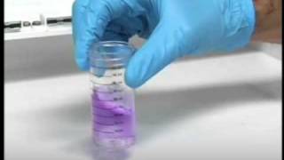 Chloride Test [upl. by Amsed]