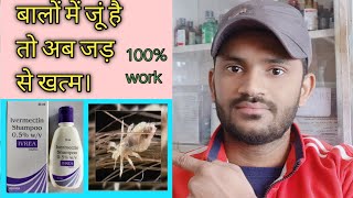 Ivrea shampu use benefits side effects full review in hindiपुरी जानकारी हिन्दी भाषा में [upl. by Cherin]