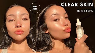 MY UPDATED SKINCARE ROUTINE  unsponsored skincare for acne [upl. by Barta]