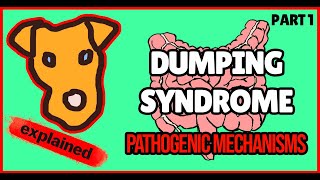 Dumping syndrome Part 1 Definition Physiology General concepts [upl. by Mort]