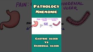 Gastric Ulcer vs Duodenal Ulcer  mnemonic  Pathology Surgery  shorts [upl. by Eladnor]