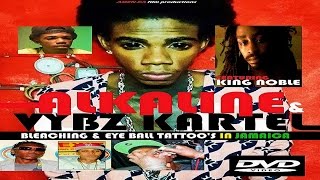 ALKALINE amp VYBZ KARTEL BLEACHING amp EYE BALL TATTOOS IN JAMAICA DVD feat King Noble HQ [upl. by Bonilla]