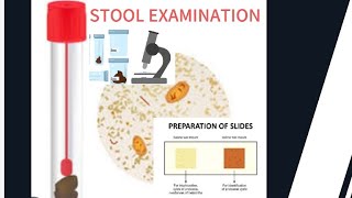 Stool examination [upl. by Pendergast]