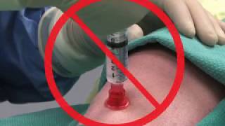 Insertion of an Intraosseous Needle in Adults [upl. by Anairdna]