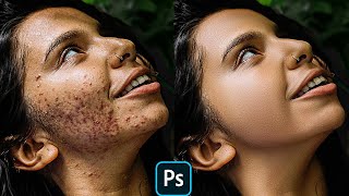 Advance High Level Skin Retouching in Photoshop  Remove Acne  اردو  हिंदी [upl. by Eivla]