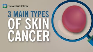 3 Types of Skin Cancer [upl. by Bartlett754]