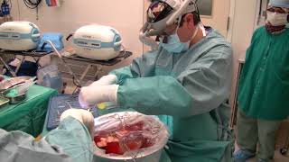 Groundbreaking Liver Surgery [upl. by Emerej]