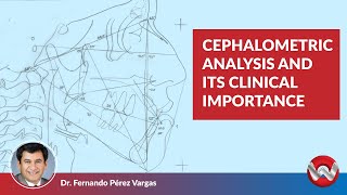 Cephalometric Analysis and its Clinical Importance [upl. by Jake706]