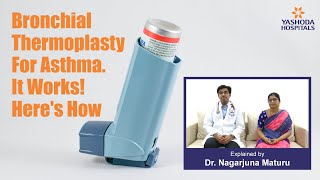 Asthma Treatment using Bronchial Thermoplasty  Best Hospitals For Asthma Treatment in Hyderabad [upl. by Marciano628]