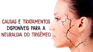 NEURALGIA DO TRIGÊMEO  Causas e tratamentos disponíveis [upl. by Esnohpla]