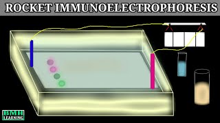 Rocket Immunoelectrophoresis  Immunoelectrophoresis [upl. by Anialed481]