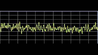 Metabolism Repair  Rife Frequencies [upl. by Mccowyn]