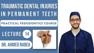 Lecture 14  Management of Traumatic Dental Injuries in PERMANENT Teeth  كورس بيدو عملي [upl. by Coady]