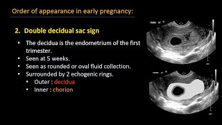 Ultrasound of normal early pregnancy [upl. by Delphine867]