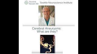 CEREBRAL ANEURYSMS Complete Overview [upl. by Elburt]